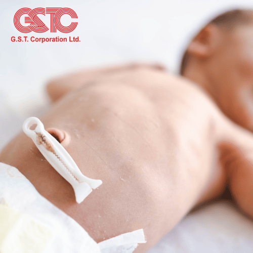 Umbilical Cord Clamping